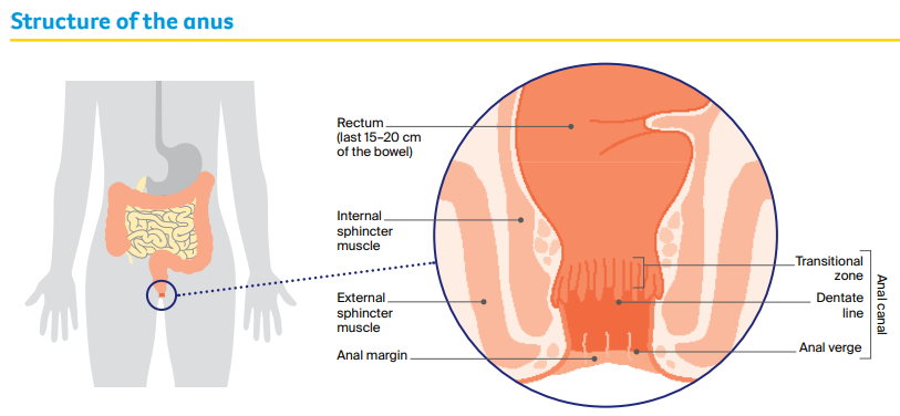 Hard Gay Anal Sex - Anal Cancer Guide: Causes and Symptoms | Cancer Council Victoria - Cancer  Council Victoria