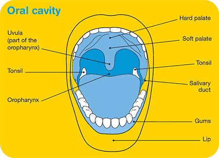 Oral Cancer Diagram