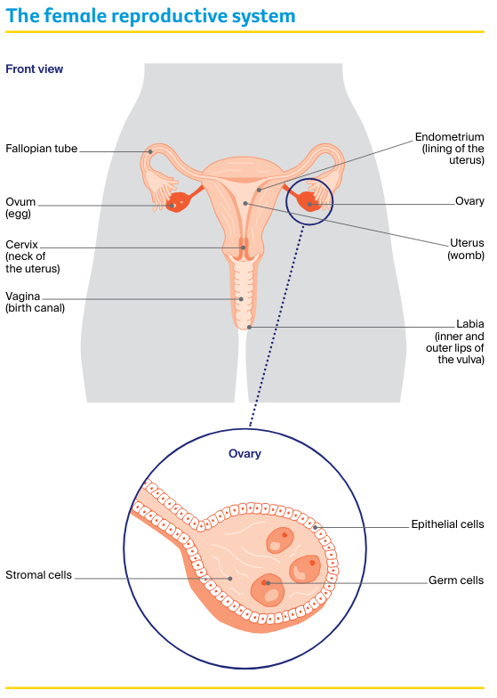 Ovarian Cancer Overview & Symptoms | Cancer Council Victoria - Cancer ...